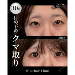 愛知春日井美容外科ネビュラクリニック 都築 諒医師の症例