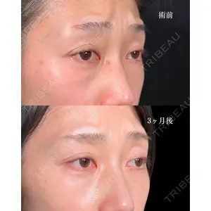 東京シンデレラ美容外科 大宮院 竹田 昌平医師の症例