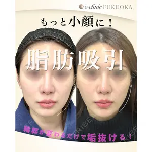 eクリニック 福岡院 伊藤 渉医師の症例