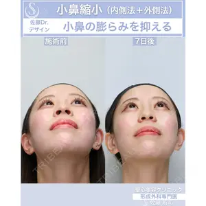 聖心美容クリニック 六本木院 佐藤 航司医師の症例