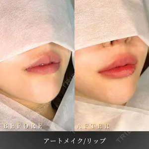 BiBiクリニックの症例
