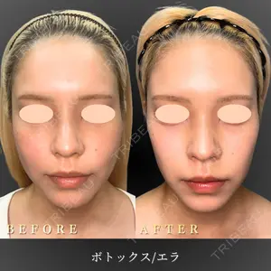 BiBiクリニック 山本 幸一郎医師の症例