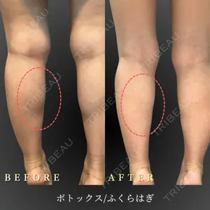 BiBiクリニック 山本 幸一郎医師の症例