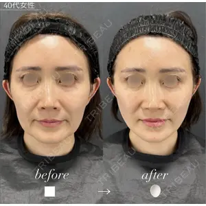 X CLINIC 恵比寿院 辻村 梢医師の症例