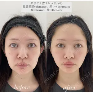 X CLINIC 恵比寿院 辻村 梢医師の症例