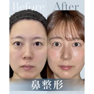 eクリニック 横浜みなとみらい院 坂本 優衣医師の症例