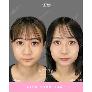 ASTRA BEAUTY CLINIC 河口 はるか医師の症例