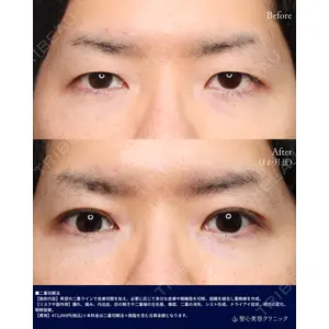聖心美容クリニック 横浜院 佐々木 直美医師の症例