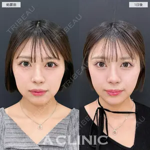 A CLINIC（エークリニック） 銀座院 新妻　克宜医師の症例
