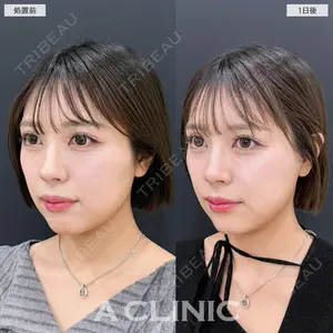 A CLINIC（エークリニック） 銀座院 新妻　克宜医師の症例