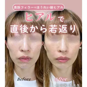 ルラ美容クリニック 神戸院の症例