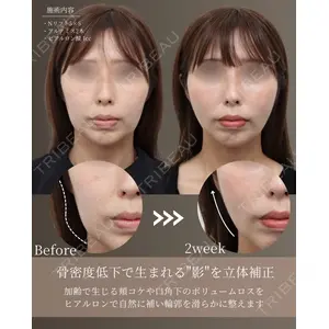 gift clinic 能登谷 翔医師の症例