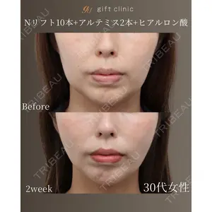 gift clinic 能登谷 翔医師の症例