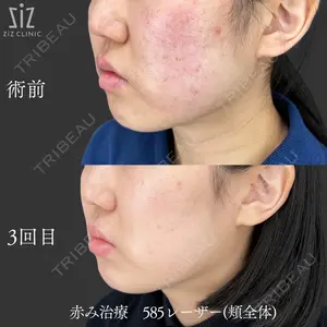 ziz CLINIC 村岡 史子医師の症例