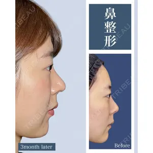eクリニック 横浜みなとみらい院 坂本 優衣医師の症例