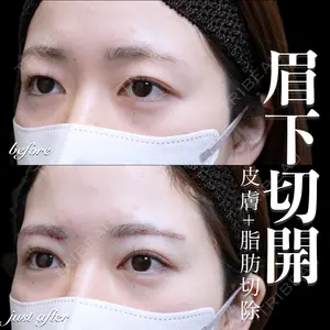 EMMO FACE CLINIC 大宮院 百瀬 直也医師の症例