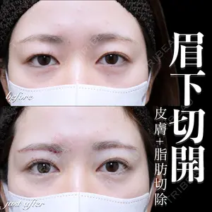 EMMO FACE CLINIC 大宮院 百瀬 直也医師の症例