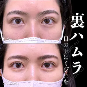 EMMO FACE CLINIC 大宮院 百瀬 直也医師の症例