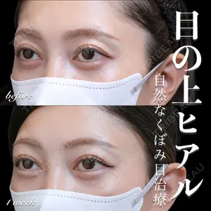 EMMO FACE CLINIC 大宮院 百瀬 直也医師の症例