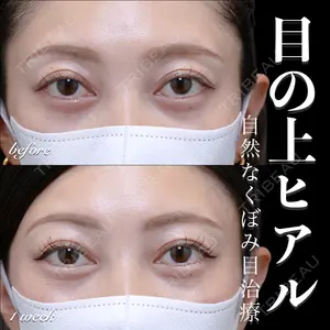 EMMO FACE CLINIC 大宮院 百瀬 直也医師の症例