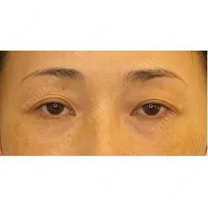 お茶の水美容形成クリニック 吉井 健吾医師の症例