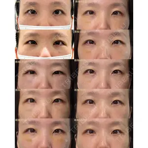 gift clinic 能登谷 翔医師の症例