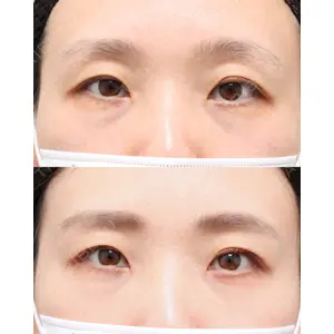 gift clinic 能登谷 翔医師の症例