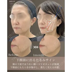 gift clinic 能登谷 翔医師の症例