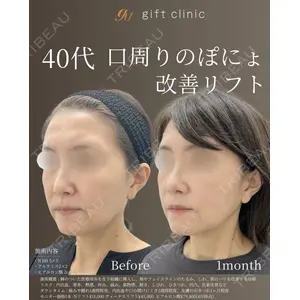 gift clinic 能登谷 翔医師の症例