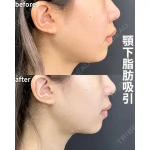 ルラ美容クリニック 名古屋栄院 / ルラスキンクリニック 名古屋栄院 牧野 裕大医師の症例