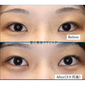 聖心美容クリニック 六本木院 星野 善允医師の症例