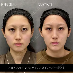 RIVER CLINIC（リバークリニック）大阪院の症例