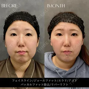 RIVER CLINIC（リバークリニック）大阪院の症例