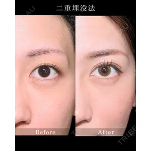 藤・ナチュレ美容クリニック 銀座院 小川 杏平医師の症例