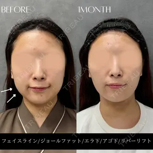 RIVER CLINIC（リバークリニック）大阪院の症例