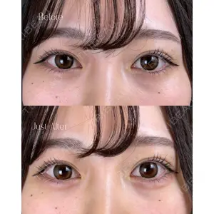 IANA CLINIC 穴井 元康医師の症例
