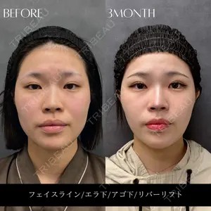 RIVER CLINIC（リバークリニック）大阪院の症例