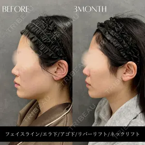 RIVER CLINIC（リバークリニック）大阪院の症例