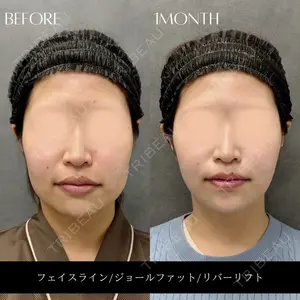 RIVER CLINIC（リバークリニック）大阪院の症例