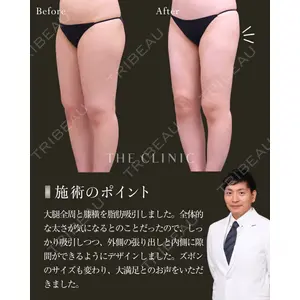 THE CLINIC（ザ・クリニック） 大阪院 黒澤 学医師の症例