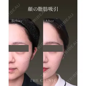 THE CLINIC（ザ・クリニック） 福岡院 安部 光洋医師の症例