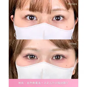 ルラ美容クリニック 新潟院 菊地 泰正医師の症例