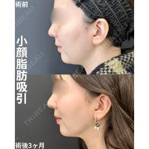 ルラ美容クリニック 名古屋栄院 / ルラスキンクリニック 名古屋栄院 牧野 裕大医師の症例