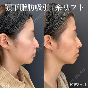 ルラ美容クリニック 名古屋栄院 / ルラスキンクリニック 名古屋栄院 関戸 優医師の症例