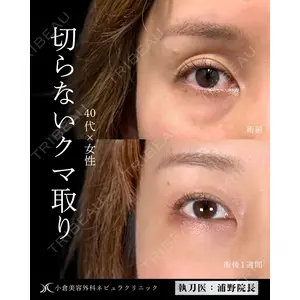 小倉美容外科ネビュラクリニック 浦野 正樹医師の症例
