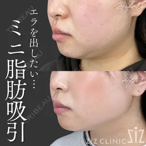 ziz CLINIC 村岡 史子医師の症例