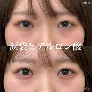 ルラ美容クリニック 名古屋栄院 / ルラスキンクリニック 名古屋栄院 関戸 優医師の症例