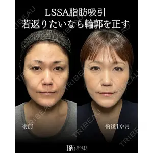 BITO BEAUTY CLINIC 伊藤 富良野医師の症例