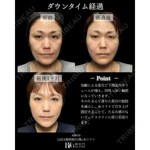 BITO BEAUTY CLINIC 伊藤 富良野医師の症例