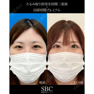 湘南美容クリニック 神戸三宮院 中川 卓医師の症例